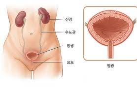 여자 클라미디아