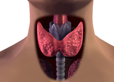 갑상선 기능 저하증