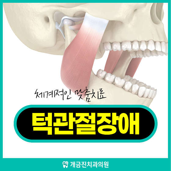 업체 사진