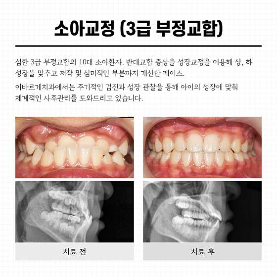 업체 사진