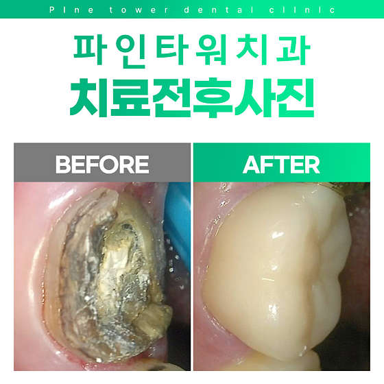 업체 사진