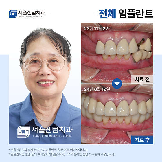 업체 사진